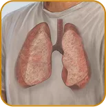 Photos representing the organs most commonly involved at baseline among patients in the AGAVE-201 trial: skin, lungs, and joints/fascia.